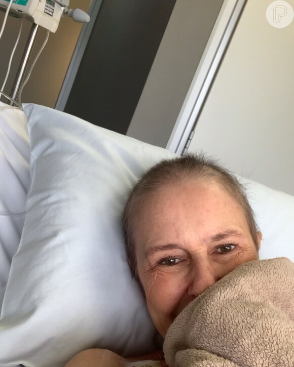 Susana Naspolini apareceu com a cabeça raspada após o câncer