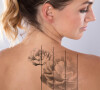 A remoção da tatuagem apaga um desenho indesejado