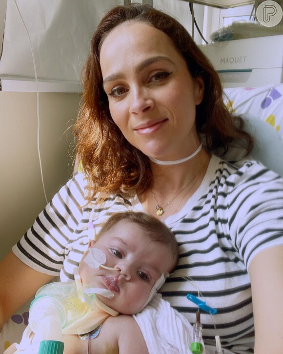 A filha de Juliano Cazarré precisou passar por uma cirurgia logo no primeiro dia de vida