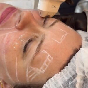Mari Bridi fez um procedimento e teve a beleza exaltada pela dermatologista Rachel Abreu: 'Está com a pele linda. Nem sei explicar'