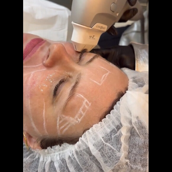 Mari Bridi fez um procedimento e teve a beleza exaltada pela dermatologista Rachel Abreu: 'Está com a pele linda. Nem sei explicar'