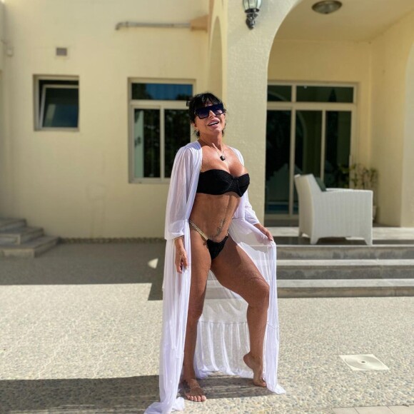 Gretchen explicou o que aconteceu com seu umbigo: ela teve pontos estourados no local porque fez show 15 dias depois de uma lipo