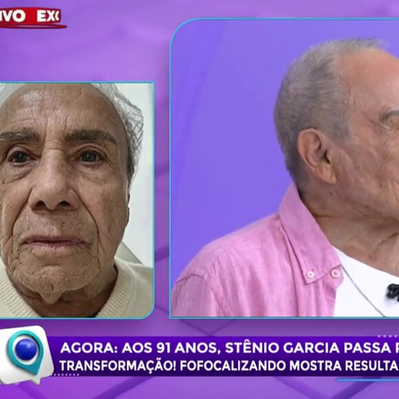 Stenio Garcia se tornou um dos assuntos mais comentados do dia após se submeter a uma harmonização facial aos 91 anos