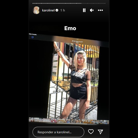 Karoline Lima fez alguns procedimentos estéticos ao longo dos anos