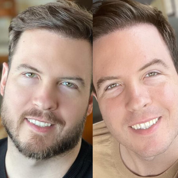 O antes e depois de Thiago Nigro. Mudou muito?