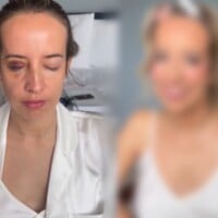Maquiagem de casamento nota 10! Noiva com olho roxo é salva por maquiadora após acidente. Veja antes e depois!