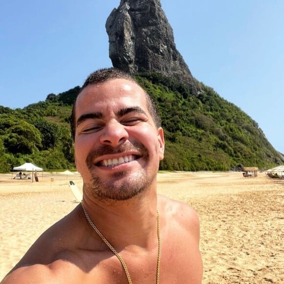 Thiago Martins brinca com acidente no trabalho: 'Depois eles não podem dizer que eu não dei o sangue pelo 'Cidade de Deus''