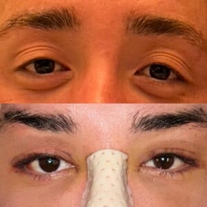 A diferença no formato dos olhos de Rico Melquiades impressiona