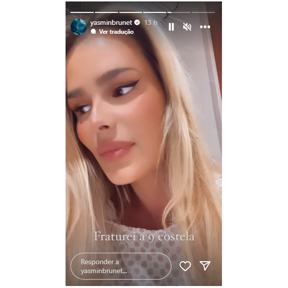Yasmin Brunet descobriu que estava com sua nona costela simplesmente quebrada