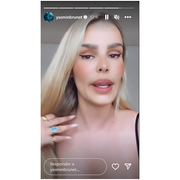 Yasmin Brunet revelou que não sabe exatamente o que fez, mas que fraturou a sua nona costela malhando na academia