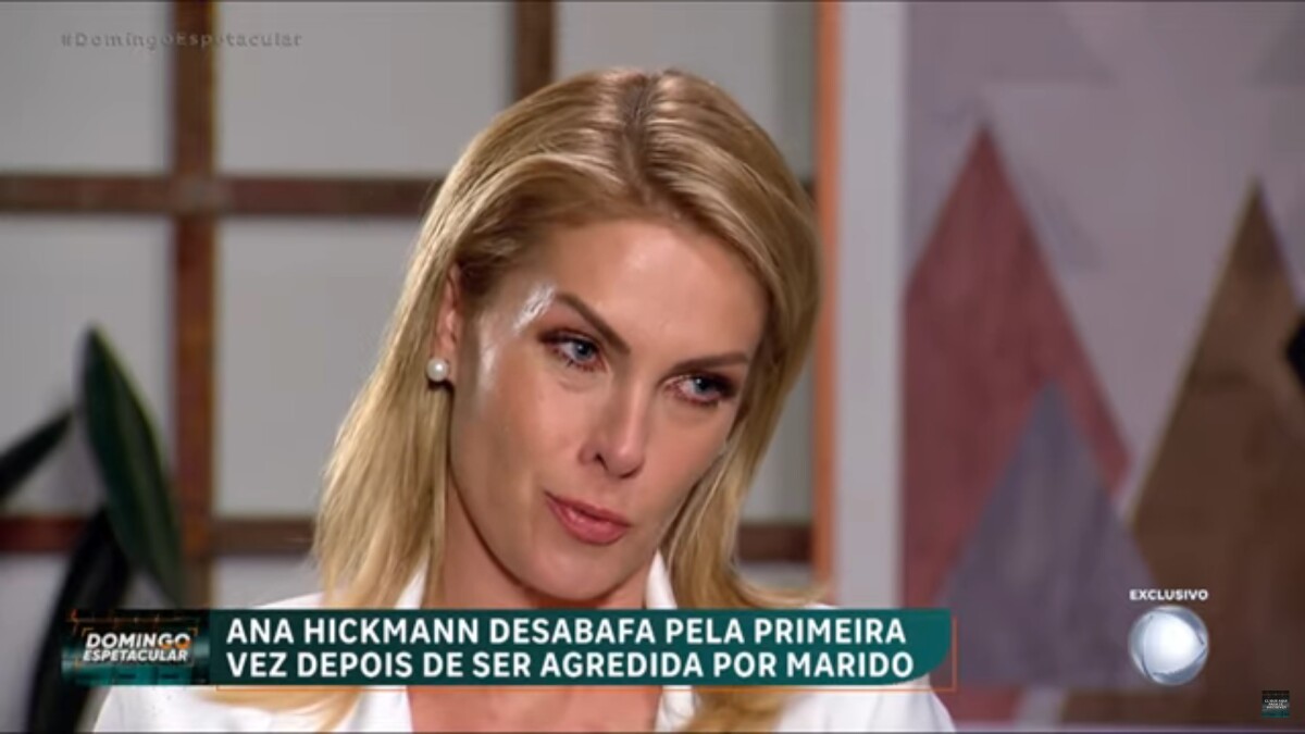 Foto Ana Hickmann Acusou O Ex Marido Alexandre Correa De Fraude