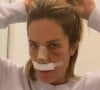 Rinoplastia de Giovanna Ewbank: apresentadora registrou todas as fases da sua recuperação da cirurgia no nariz e compartilhou depois do período de repouso com os fãs em vlog postado em 22 de agosto de 2023 no seu canal do YouTube