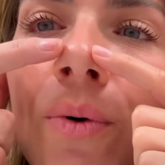 Giovanna Ewbank realizou uma cirurgia no nariz em agosto de 2023
