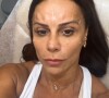 Viviane Araujo resolveu passar por um procedimento estético e aplicou botox no rosto