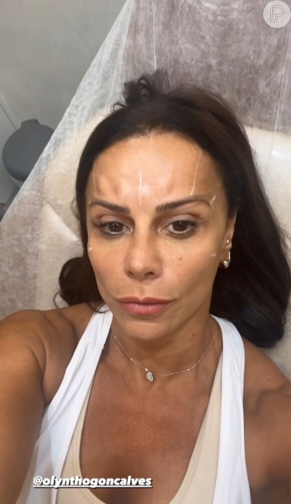 Viviane Araujo resolveu passar por um procedimento estético e aplicou botox no rosto
