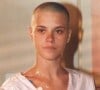 A atriz Carolina Dieckmann raspou o cabelo para a novela 'Laços de família' de 2000