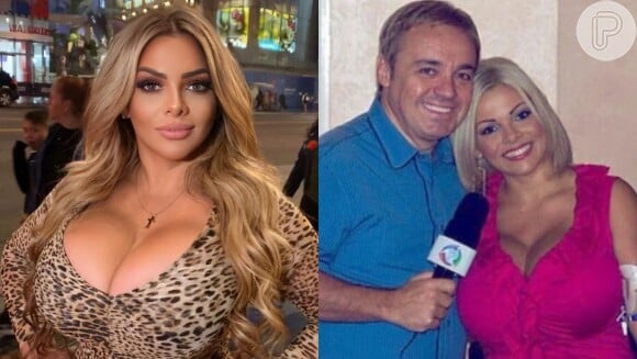 Como está Sheyla Hershey hoje? Brasileira chegou a ter os maiores seios do mundo