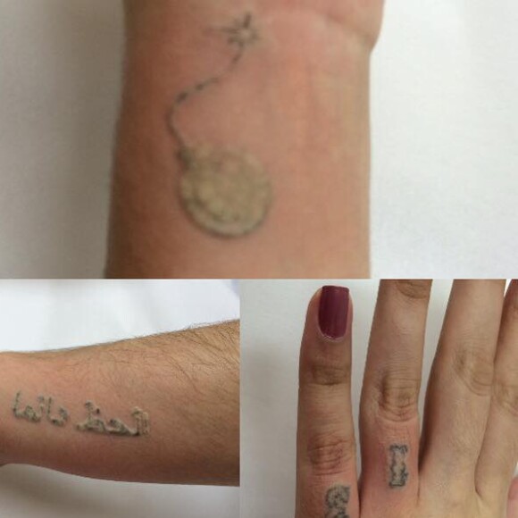 Andressa Urach: quando se converteu à religião evangélica, a modelo havia apagado parte das tatuagens
