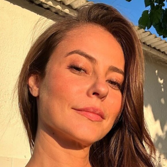 Paolla Oliveira posa sem maquiagem e deixa à mostra problema de pele comum entre mulheres