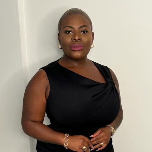 Jojo Todynho passa por cirurgias plásticas e médico comenta resultados no corpo da cantora