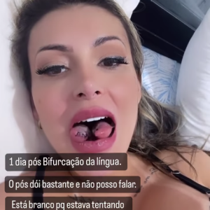 Desde então, Andressa Urach tem atualizado seu estado dia após dia da bifurcação na língua