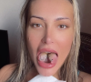 Andressa Urach tem causado polêmica e foi detonada nas redes sociais por causa da cirurgia