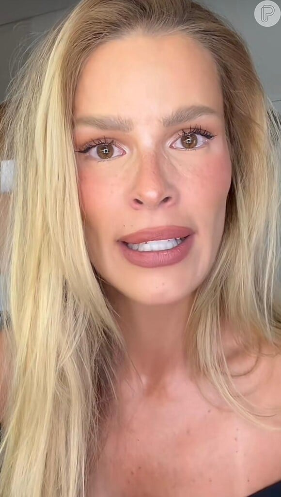 'Testa cheia de botox': Yasmin Brunet é detonada por internautas após tentar se arriscar na atuação