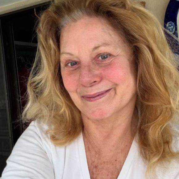 No entanto, a famosa atriz também tranquilizou os fãs dizendo que já está melhor. Ainda mencionou que tirou as fotos sem make e sem filtro, confiante de que logo vai ficar 100% boa.