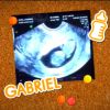 Fernanda Gentil está grávida de 11 semanas do primeiro filho, Gabriel, fruto de seu casamento com Matheus Braga