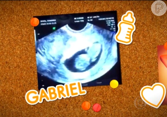 Fernanda Gentil está grávida de 11 semanas do primeiro filho, Gabriel, fruto de seu casamento com Matheus Braga