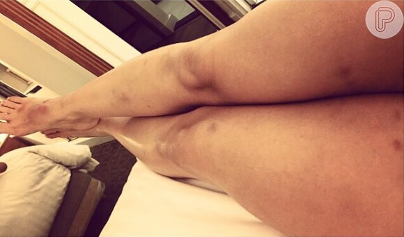 Prova disso é que nesta quinta-feira, 9 de julho de 2015, Cleo Pires mostrou em seu Instagram sua perna com várias manchas roxas: 'Cheia de hematomas e orgulhosa deles, ta valendo a pena!'