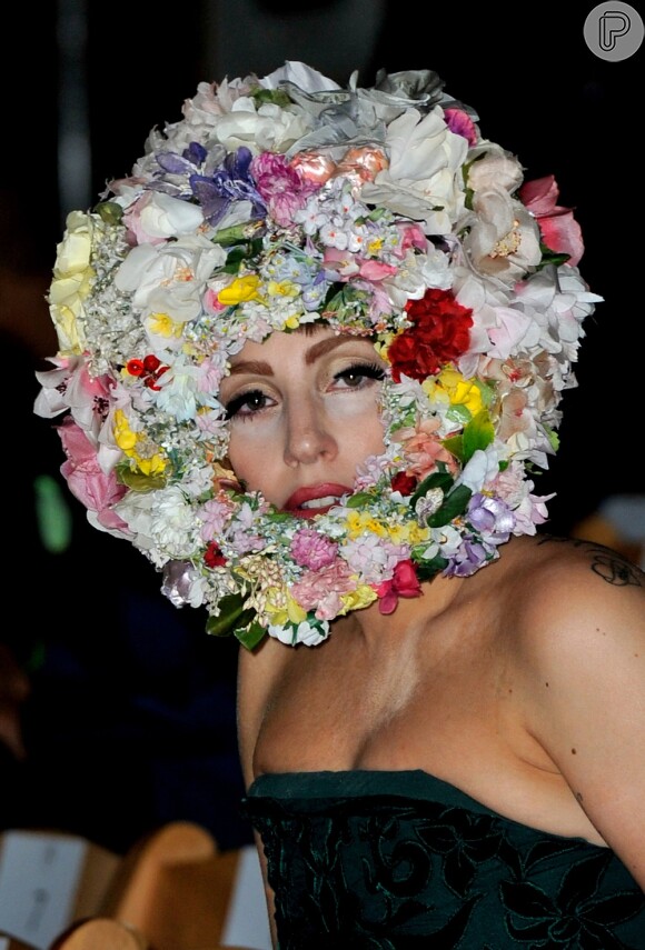 Lady Gaga está se recuperando de uma cirurgia no quadril