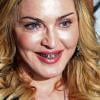 Madonna inaugurou a sede de Roma da academia Handy Candy Fitness e escolheu um acessório inusitado para o evento. A cantora usou um bling, uma armação de ouro que cobre parte dos dentes