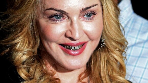 Madonna inaugura academia com acessório de ouro nos dentes, o grillz