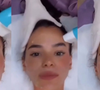 'Toda esticada e zero preenchida': hoje com 30 anos, Bruna Marquezine faz 'poupança de colágeno' com ultrassom que reduz a flacidez e ameniza rugas