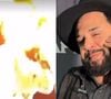 O cantor sertanejo Léo, dupla de Raphael, sofreu queimaduras no rosto durante um show