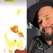 Cantor sertanejo Léo tem rosto queimado durante show após ser atingido por efeitos especiais. Atenção: imagens fortes!