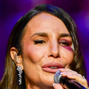 Ivete Sangalo chegou a se apresentar de olho roxo após acidente