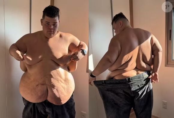 Gordão da XJ também mostrou como ficam hoje as roupas que ele usava quando pesava 350 kg
