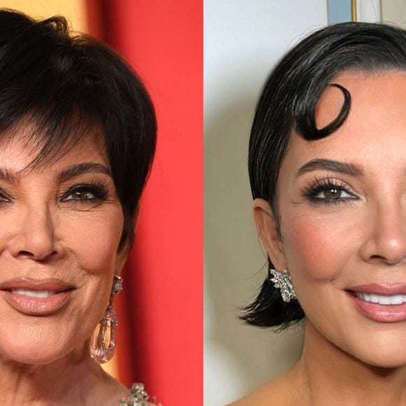 Kris Jenner chocou ao 'mudar de rosto' aos 69 anos após cirurgia plástica