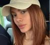 'Irreconhecível': Anitta abre álbum de fotos com selfies e nova aparência após procedimento estético volta a viralizar nos comentários