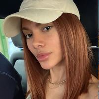 'Irreconhecível': Anitta abre álbum de fotos com selfies e nova aparência após procedimento estético volta a viralizar nos comentários