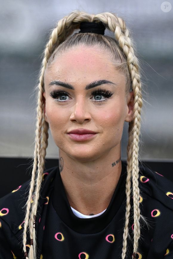 Uma das principais mudanças de Alisha Lehmann foi um preenchimento labial sutil