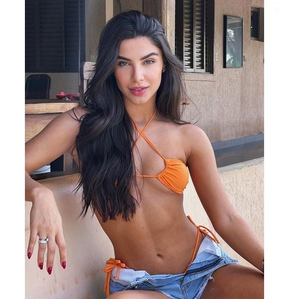 Gabriela Versiani  optou por um procedimento menos invasivo para harmonizar o nariz.