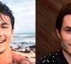 O ex-BBB Eliezer deu o que falar com sua harmonização facial. Depois de muito exagero, ele desfez o procedimento