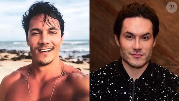 O ex-BBB Eliezer deu o que falar com sua harmonização facial. Depois de muito exagero, ele desfez o procedimento