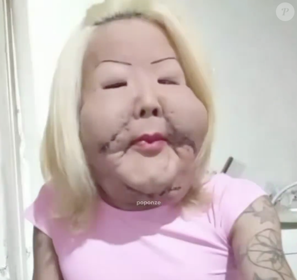 Juju do Pix está se recuperando do procedimento e garante que não sente mais dores