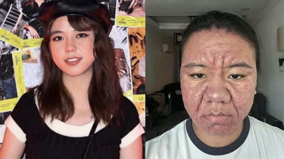 Mulher malaia choca ao exibir mudança extrema na pele durante a gravidez, vídeo viraliza e rebate críticas à sua aparência: 'Afeta minha saúde mental'