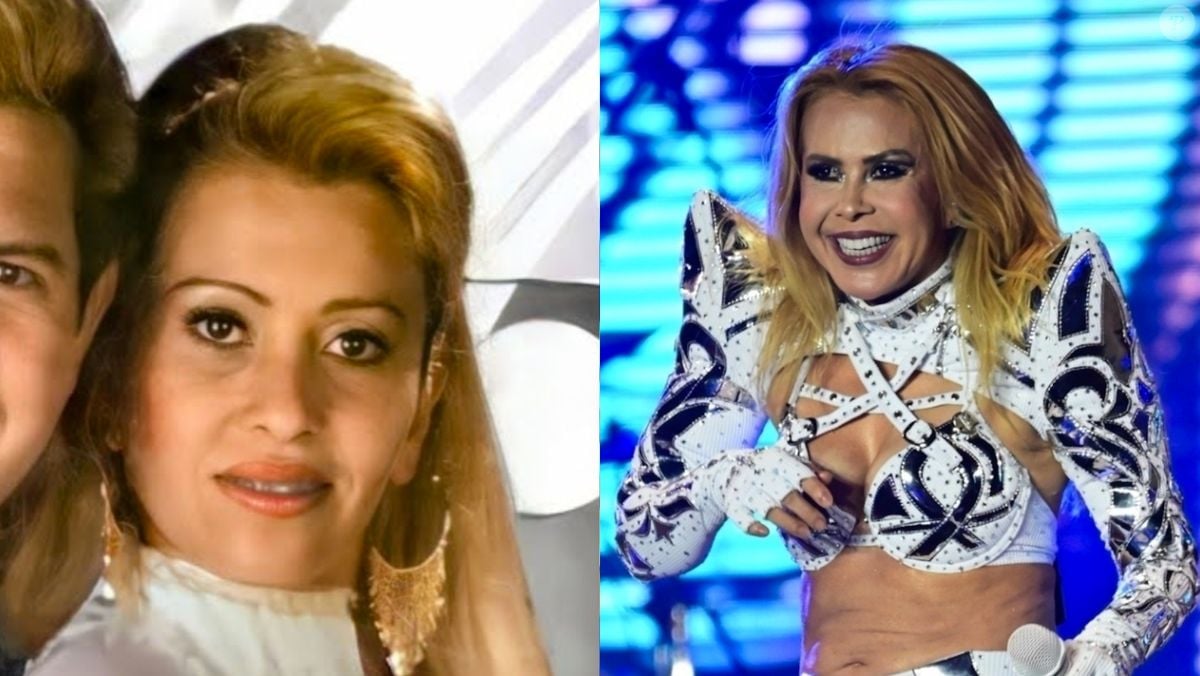 Foto: Antes e depois de Joelma: cantora mudou seus traços com cirurgias e  procedimentos estéticos e divide opiniões - Purepeople
