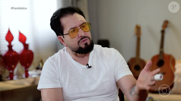 Marrone apareceu no 'Fantástico' para comentar sobre seu acidente e deixou muita gente chocada por sua aparência